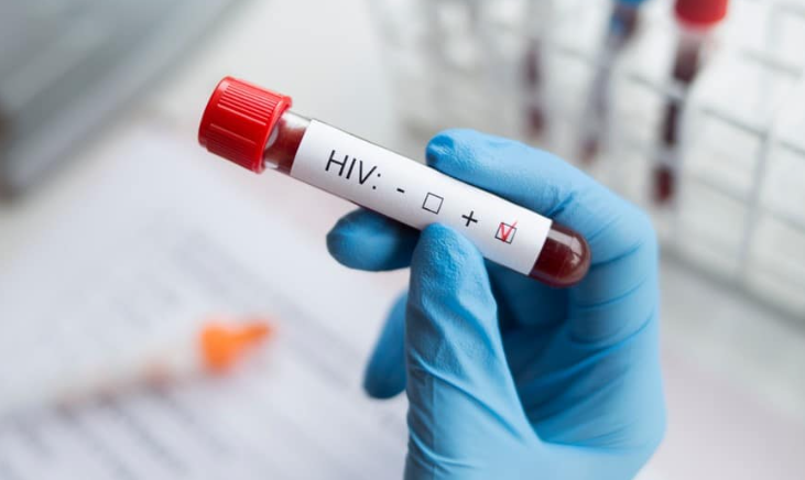 aids-hiv
