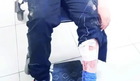 Sokak köpekleri 10 yaşındaki çocuğun üzerine çullandı