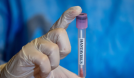 hanta-virus-2026-1