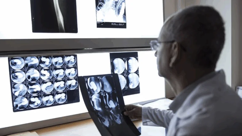 doktor-hekim-teshis-meme-kanseri